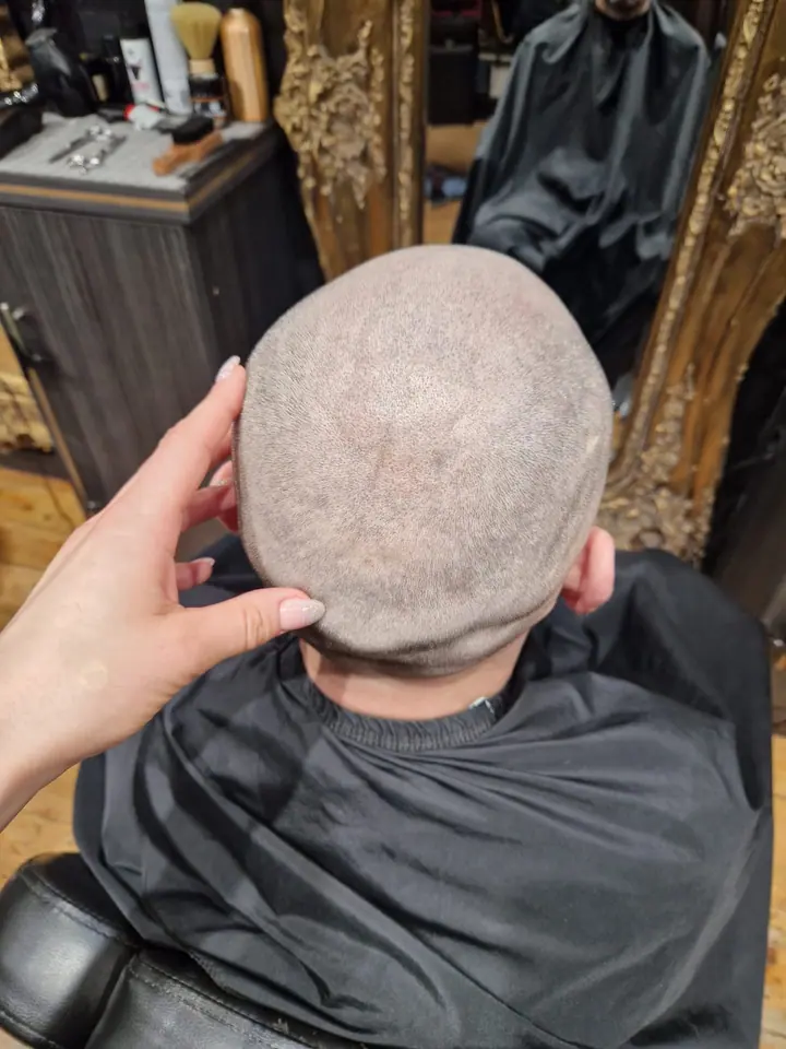 Scalp micropigmentation on the crown, seen from above beside a gilded mirror